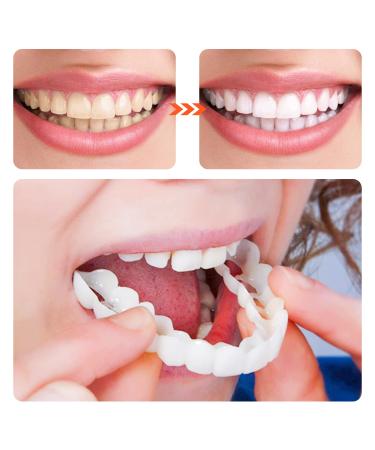 2 PCS Veneers Dentures Socket for Women and Men - Temporary Tooth Repair | Bright White Dental Veneers for Upper and Lower Jaw - Protect & Restore Your Smile - Buy Online on GoSupps.com