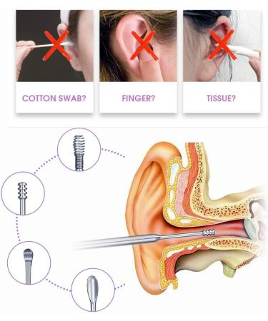 Portable 6-in-1 Ear Wax Removal Tool Kit with Metal Storage Case - Stainless Steel Ear Pick Curette Cleaner Spoon by SHJYKRU - Buy Online on GoSupps.com