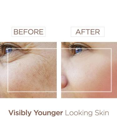 Buy BEE and YOU Anti Aging Face Cream Serum - Dark Spot Remover & Pore Minimizer with Bee Propolis Raw Honey & Hyaluronic Acid | 1.0 fl. Oz - International Shipping Available - Buy Online on GoSupps.com