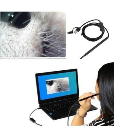 Earwax Removal Kit with Camera | Home Ear Cleaning Tool - Buy Online on GoSupps.com