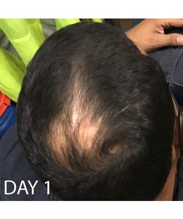 Biotin Hair Growth Conditioner - High Potency Anti Hair Loss Treatment with Vitamins E, A, and C - 8.5 Ounce - Buy Online on GoSupps.com