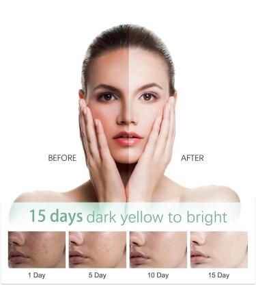 Miake Face Wash for Women Whiten Cleanser for Glowing Skin 120g Makeup Remover and Facial Cleanser Brightens and Refreshes Your Skin for Combination and Oily Skin Miake - Buy Online on GoSupps.com