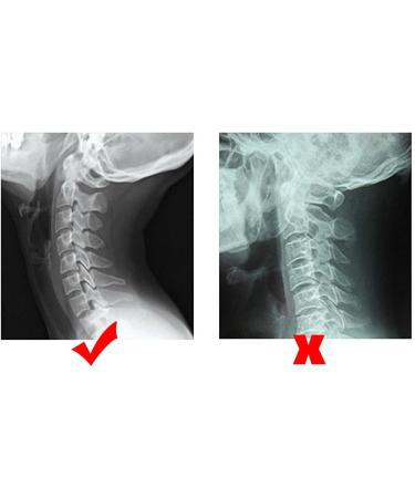 SH-RUIDU Cervical Vertebrae Traction Kit | Adjustable Neck Bandage for Pain Relief & Spine Decompression - Buy Online on GoSupps.com