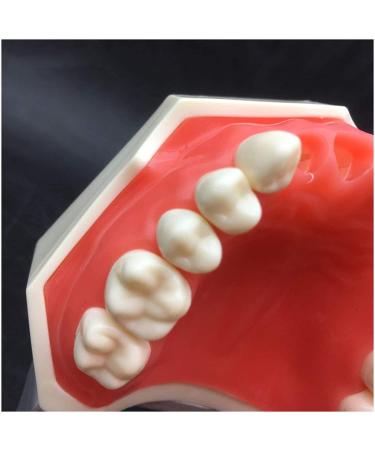 Vinbcorw Dental Care Model - 24 Removable Teeth for Adult Teaching (12x9.5 cm) - Ideal for Dentists & Educators - Buy Online on GoSupps.com