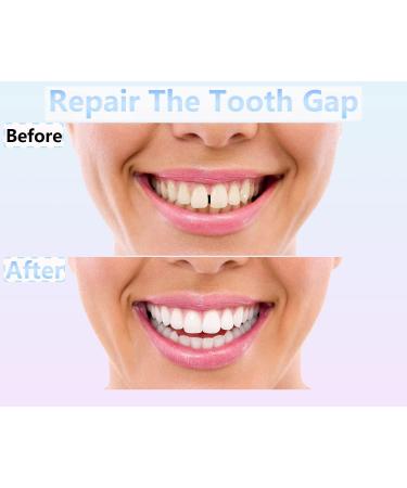 Temporary Tooth Repair Beads for Chipped Teeth - Dental Filler for Missing/Broken Teeth (50g) - Buy Online on GoSupps.com