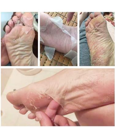 Rejuvenating Foot Mask - Dead Skin Peeling Treatment for Smooth Feet | International Shipping - Buy Online on GoSupps.com