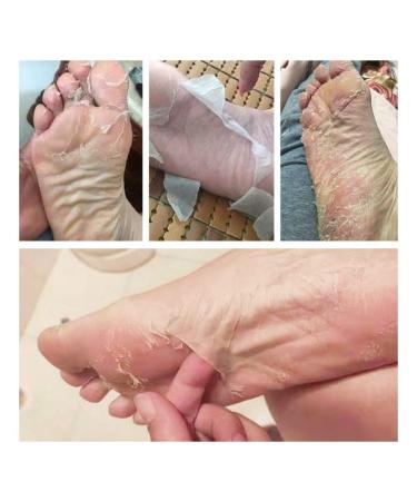 5pcs Moisturizing Foot Peeling Mask - Gentle Dead Skin Remover for Sensitive Feet | Foot Care Socks - Buy Online on GoSupps.com