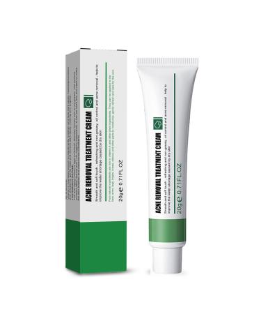 Anti Acne Face Cream Spot Cream for Acne Treatment and Spot Treatment with Nicotinamide Sodium Hyaluronate Aloe for Blackheads and Acne Prone Skin Reduces Spot Size Redness and Inflammation