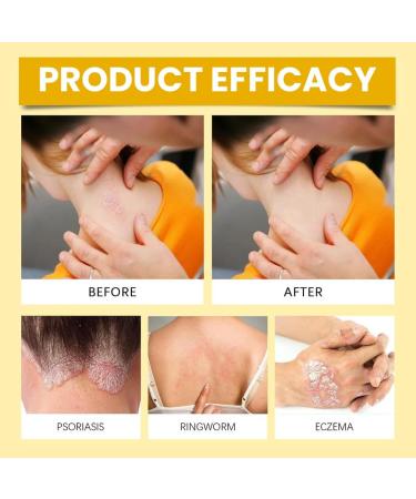 Bee venom creme venin d'abeilles 60g pommade professionnelle au venin d'abeille pour tous types de peau - Buy Online on GoSupps.com