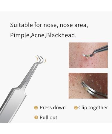 FIXBODY Stainless Steel Blackhead and Splinter Remover Tools Kit - Professional Treatment for Pimples, Whiteheads, Acne, and Ingrown Hairs - Buy Online on GoSupps.com