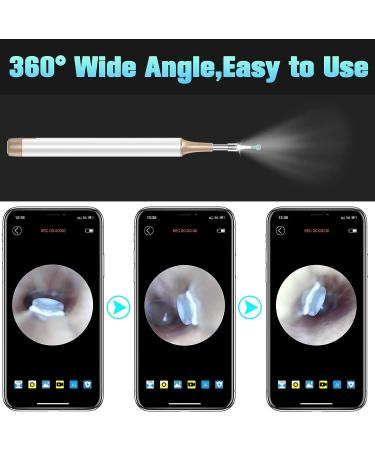 Wireless Ear Otoscope with Camera, Ear Wax Removal Tool, Cleaner & Light - White - Buy Online on GoSupps.com
