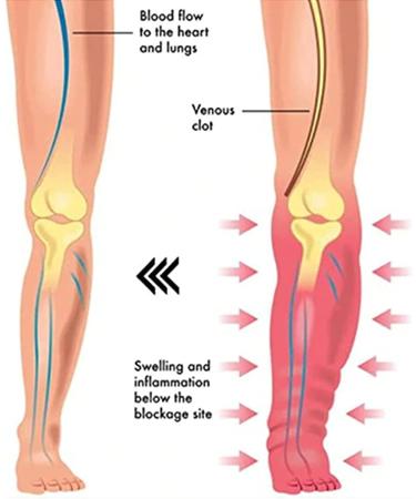 NBZZ Lymphdrainage Magnetic Bracelet - Exquisite Energy Health Bracelets for Arthritis | Perfect Mother's Day Gift - 4PCs - Buy Online on GoSupps.com