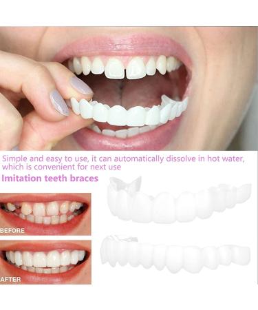 Denture Teeth Snap On Veneers for Men and Women - Temporary Fake Teeth for Confident Smile (2 Pcs) - Buy Online on GoSupps.com
