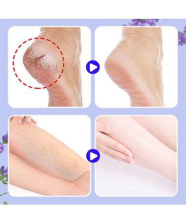 Nourishing and repairing cream for cracked feet nourishing and repairing foot balm moisturizes and soothes cracks and dryness. (2 pieces) - Buy Online on GoSupps.com