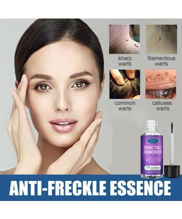 Skin Tag Removal Solution.(2PC 30ML) 2PC 30ml - Buy Online on GoSupps.com