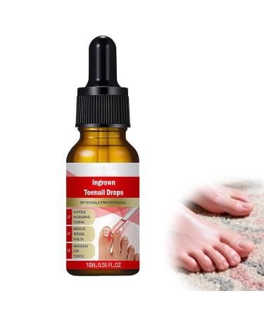 XPEX 30ml Mycose Ongles Des Pieds Strengthens and Revitalizes Nails pour Nails Damaged by Mycosis or Light Trauma pour D color s Endommag s et pais