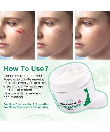 Aliver Scar Removal Cream - Stretch Mark & Acne Remover for Men & Women - Effective Treatment for Old & New Scars, Cuts, and Keloids - Buy Online on GoSupps.com