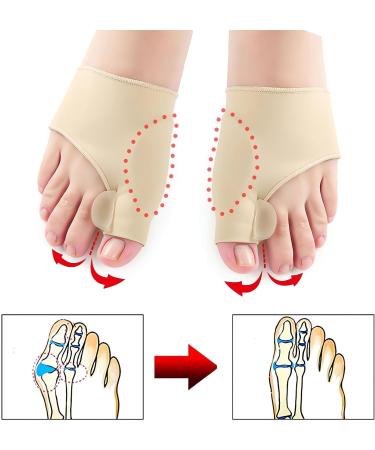 Bunion Corrector Socks - Orthopedic Bunion Relief for Men & Women - Big Toe Straightener Brace - Hallux Valgus Corrector - 2 Pairs Beige - Buy Online on GoSupps.com