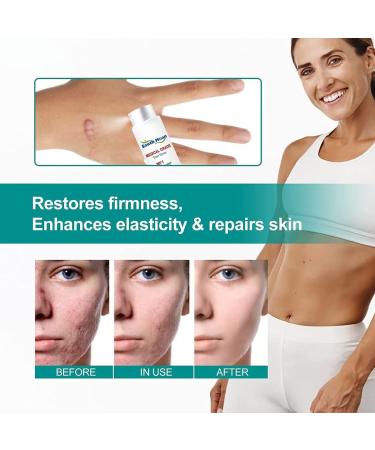ZRRCYY Scar Remove Advanced Spray for Acne & Surgical Scars - 2pcs - Buy Online on GoSupps.com