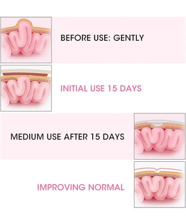 Infant Hernia Belt 2pcs - Pink | Newborn Umbilical Cord Hernia Care for Baby | Navel Protection Belt - Buy Online on GoSupps.com