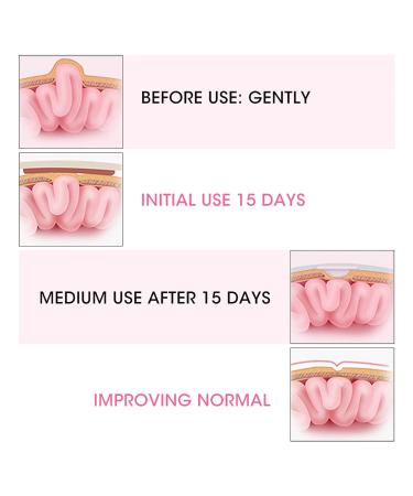 Baby Hernia Therapy Belt for Toddlers | Comfortable 2-Pack Treatment | Pink 0-1 Years - Buy Online on GoSupps.com