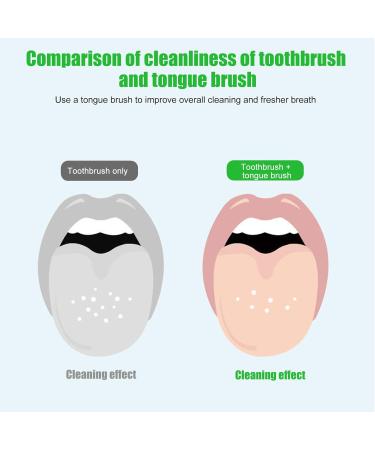 Toatelu 15-Piece Soft Tongue Cleaner Set - Tongue Scraper & Brush for Bad Breath - Individually Packaged Random Colors - Buy Online on GoSupps.com