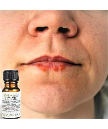 Cold Sore Lip Oil - Natural Herbal Treatment for Fast Relief - Vegan Formula - Buy Online on GoSupps.com