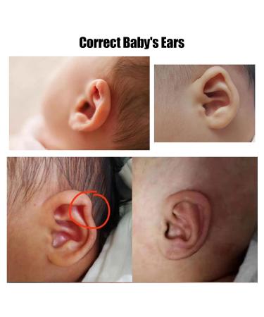 Skin-Friendly Silicone Ear Cushions for Infants | Long-Term Protruding Ear Stickers - 4cm x 100cm Roll - Buy Online on GoSupps.com