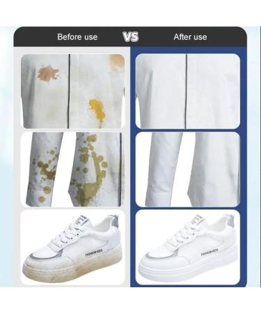 Clothes Stain Removal Wipes Stain Removal Wet Wipes Dry Cleaning Wipes For Clothes Individual Wrapped Cleaning Wipes Down Jacket Dry Cleaning Agent (40PCS) - Buy Online on GoSupps.com