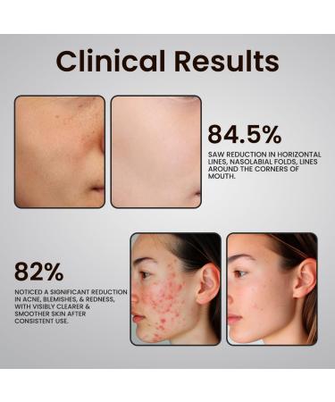 Glutathione Serum with 5+ Peptides - Brightening Anti-Hyperpigmentation Face Serum - 20 000ppm for Dark Spots & Aging Signs - Niacinamide & Hyaluronic Acid - 5 Serums in 1 - Buy Online on GoSupps.com