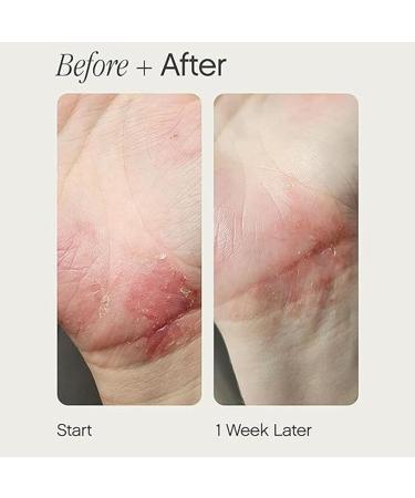 Cr me hydratante au beurre pour peaux s ches sensibles et sujettes l'ecz ma soin hydratant et apaisant imm diat et soulagement de l'ecz ma pour le visage et le corps hydratation de la peau - Buy Online on GoSupps.com