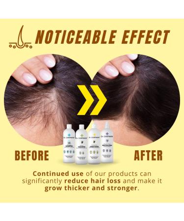 Dr. Carpman Volume Enhancing Anti Hair Loss Lotion - 8 fl. oz. - Hair Care with Natural Extracts for Strengthening & Growth - Buy Online on GoSupps.com