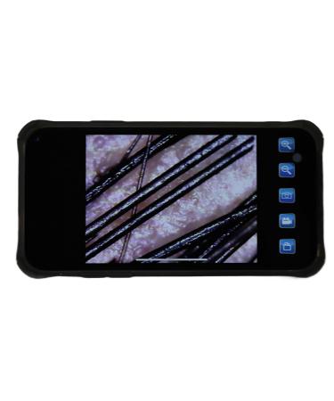 100x Skin & Hair Detector | WiFi Follicle Analyzer for Scalp Health | 0.3 MP Hair Diagnosis Tool - Shop Internationally! - Buy Online on GoSupps.com