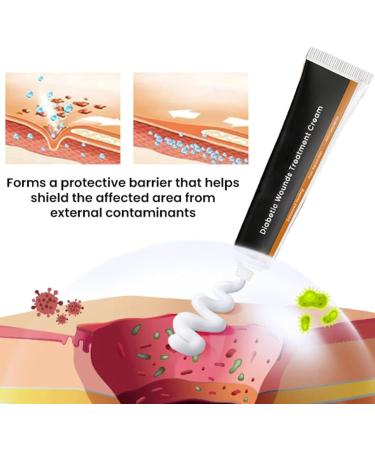  Jingmiger Foot Cream | 30g Natural Softening Moisturizer Repair Lotion For Cracked Heels And Feet | For Hydration Care Sensitive Cracked Heels Adults Sports Daily Night - Buy Online on GoSupps.com