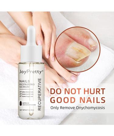 Lurrose Nail Repairing Serum 20ml - Onychomycosis Softening Solution for Discolored Nails - Nails Treatment Oil for Damaged Nails - Buy Online on GoSupps.com