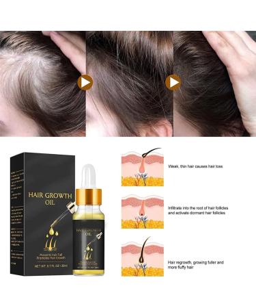 Tress Diary Hair Growth Oil for Black Women and Men Essential Oil for Hair Growth - Buy Online on GoSupps.com