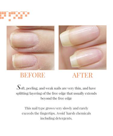 Nail Tek Foundation 2 Ridge Filling Base Coat 0.5 oz - Strengthen Soft & Peeling Nails - Buy Online on GoSupps.com