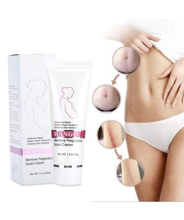 Stretch Mark Cream - Effective Pregnancy & Scar Treatment | Elimina Estr as - Buy Online on GoSupps.com