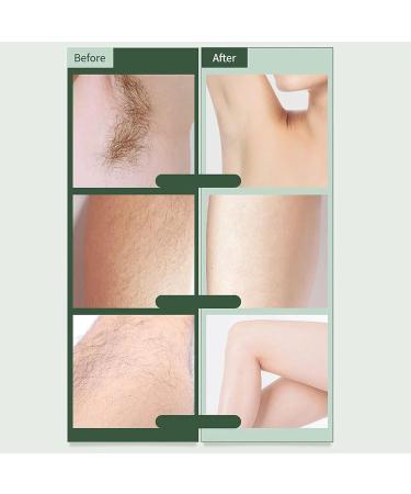 Buy Electric Bikini Hair Remover - Battery Operated Bikini Shaver with LED Light for Women | Smooth At-Home Hair Removal - Buy Online on GoSupps.com