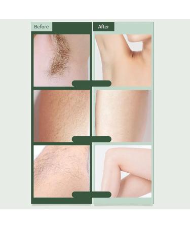 Portable Electric Bikini Razor for Women - Safe Dry Use Trimmer with LED Light for Bikini & Leg Hair Removal - Buy Online on GoSupps.com