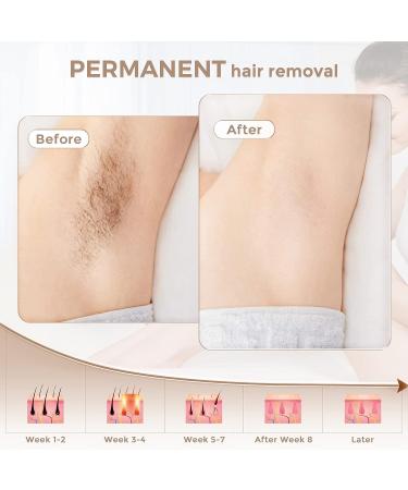 LVARA FDA Cleared IPL Hair Removal Device - Painless At-Home Laser Hair Remover for Women & Men - 999,999 Flashes for Facial, Bikini, Legs, & Armpits - Buy Online on GoSupps.com