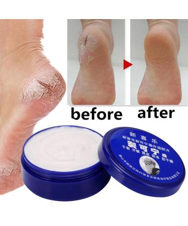 Lintat Hand & Foot Crack Cream | Natural Moisturizer for Dry Skin Heels & Chapped Skin | Anti-Dry Ointment for Int'l Shipping - Buy Online on GoSupps.com