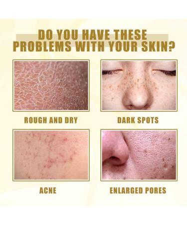 2024 New Exfoliating Cleansing Oil | Centella Deep Cleansing Moisturizer for All Skin Types - Buy Online on GoSupps.com