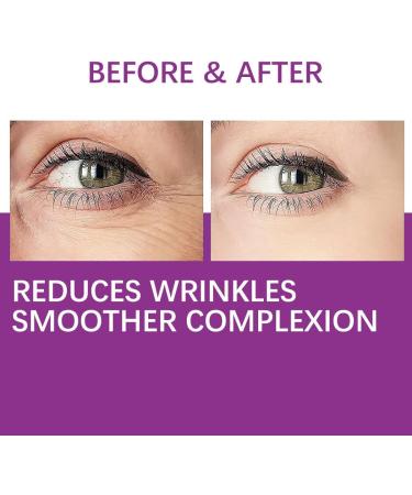 Vitamin C + Retinol Eye Cream Eye Cream for Dark Circles and Bags Under Eyes Anti Aging Eye Cream Collagen Eye Cream Reduces Fine Lines Wrinkles - Buy Online on GoSupps.com