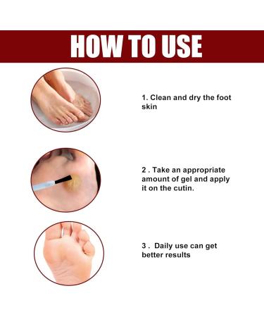 RZAJJN GFOUK Foot Corn Removal Extra Strength Gel 10ml - 2pcs - Buy Online on GoSupps.com