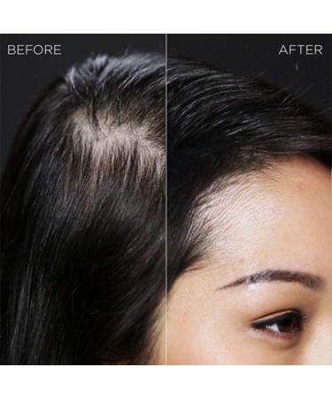 IMMETEE Keratin Hair Building Fibers Powder - Conceal Thinning Hair, Cover Hair Loss - Dark Brown - 25g/0.88oz - Buy Online on GoSupps.com