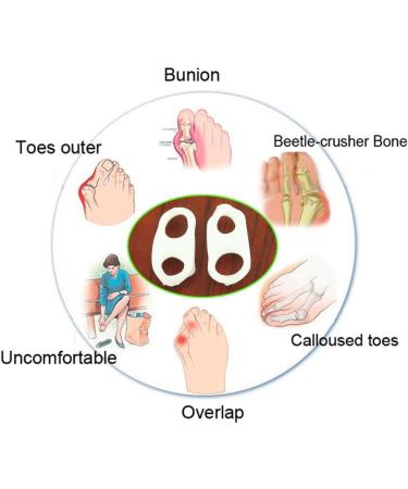 Pedimends Soft Silicone Toe Separator for Small Toes - Orthopedic Hallux Valgus Relief & Protection | Foot Care Solution - Buy Online on GoSupps.com