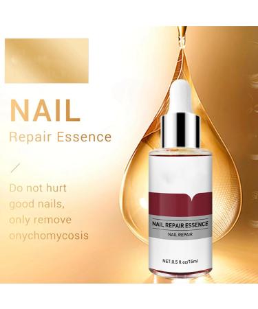 Nail Oil Cuticle Oil for Foot & Fingernails - 15 ml Repair & Protect Cuticle Oil Nail Care Oil - Nail Care Nail Polish Strengthens Nourishes Cracked Brittle Nails - Nail Repair Essence - Buy Online on GoSupps.com