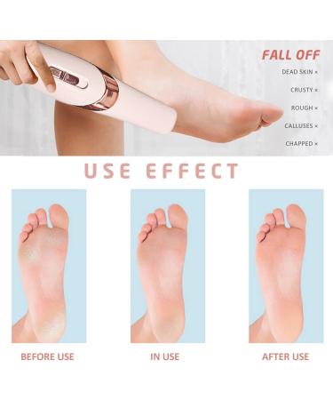 1 Piece Electric Foot Grinder Automatic Pedicure Tool Rechargeable Waterproof Hard Skin Remover with 2 Foot Grinders and 2 Cleaning Brushes for Calluses and Cracked Heels Foot Care - Buy Online on GoSupps.com