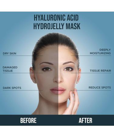 Hyaluronic Acid Jelly Mask - Professional Hydro Glo Peel-Off Mask for Hydration Soothing Skin & Glowing Skin Suitable for All Skin Types Vajafacial Jelly Mask | 12 Applications (30 Fl Oz) - Buy Online on GoSupps.com